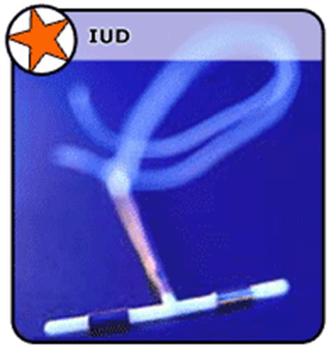 Iuds (intrauterine devices) types, side effects, and effectiveness. IUD