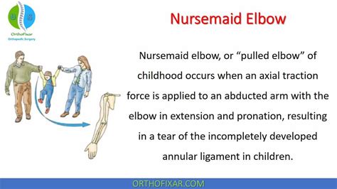 Nursemaid Elbow
