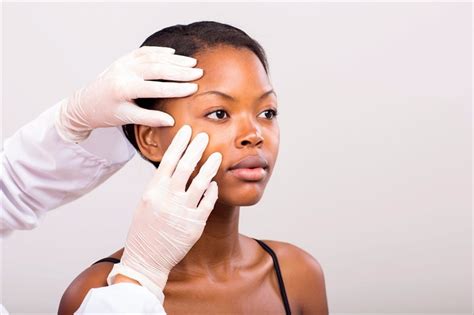 When To Seek Medical Treatment For Acne