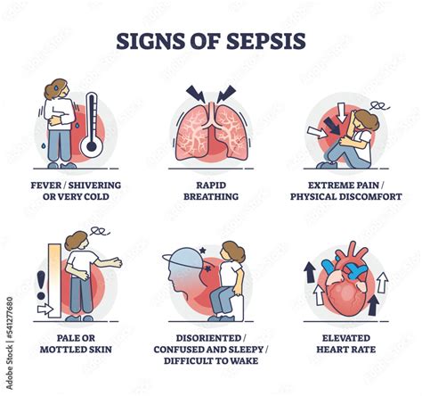 Signs Of Sepsis As Infection Blood Poisoning Symptoms Outline Collection Labeled Educational