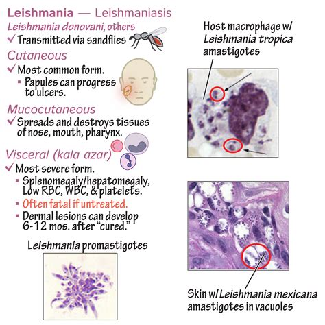 Immunology Microbiology Glossary Protozoa Leishmania Leishmaniasis Draw It To Know It