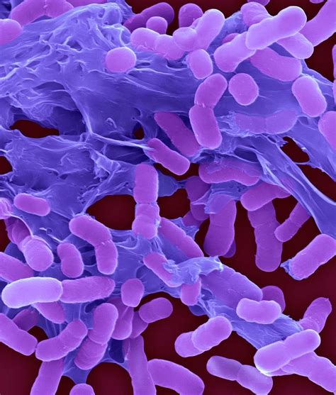 Acinetobacter Baumannii 3 Photograph By Dennis Kunkel Microscopy