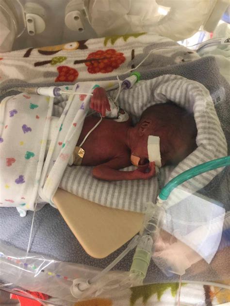 Premature Baby Amari Moore Born Four Months Early At Ounces