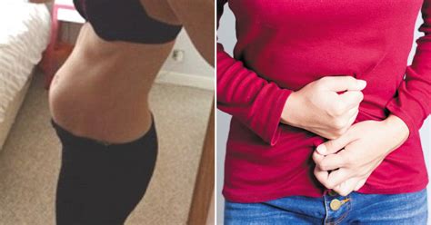 21 Year Old Woman Whose Stomach Was Bloated For Months Discovered What