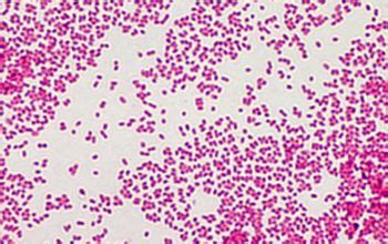 Describe the infections caused by haemophilus influenzae and haemophilus ducreyi. Haemophilus influenzae