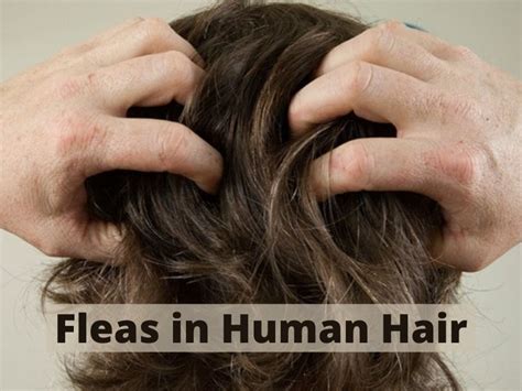 Fleas In Human Hair Causes Symptoms And Treatments Kalista Salon