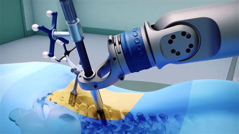 Spinal Surgical Robotics A Technical Overview And Key Concept Review