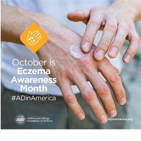 October Is Eczema Awareness Month Arizona Asthma And Allergy Institute