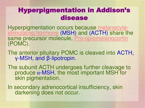 Ppt Biochemistry Of Addisons Disease Powerpoint Presentation Free