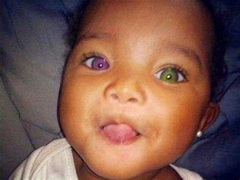niños africanos con ojos impresionantes Son sin duda los más bellos del mundo Different
