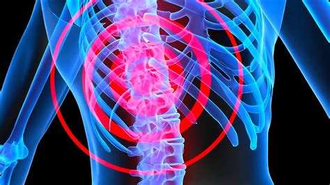 Spine Fracture And Spinal Cord Injury Dr Khandaker Abu Talha