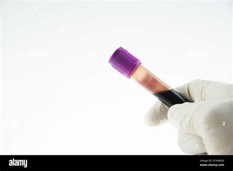 Vacutainer Edta Blood Collection Tubes Stock Photo Alamy