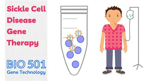 Gene Therapy For Sickle Cell Disease Modification Of Stem Cells Youtube