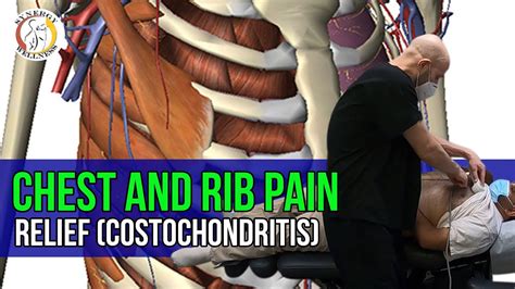 Chest And Rib Pain Relief Costochondritis With Laser Therapy Youtube