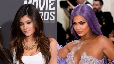 Kylie Jenners Beauty Evolution