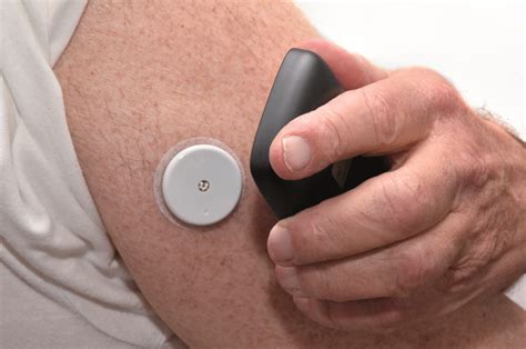 Nhs England To Fund Flash Glucose Monitoring Devices For All Eligible