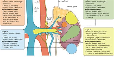Not all tests listed below will be used for every person. Renal/ Kidney cancer | notes.nursium.com