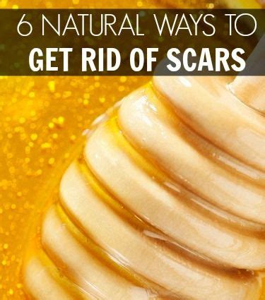14 items in this article 5 items on sale! 13 best For Scars images on Pinterest | Beauty hacks ...