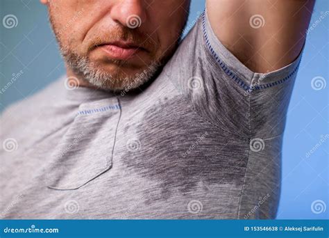 Young Man With Sweat Under The Armpit And Have A Foul Odor Health And
