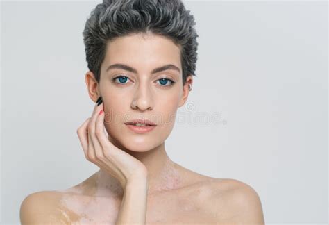 Vitiligo Woman Beauty Portrait Stock Image Image Of Color Adult