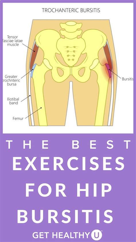 The Best Exercises For Hip Bursitis An Immersive Guide By Get Healthy