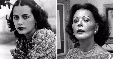 11 Classic Hollywood Stars Who Had Plastic Surgery Vintage Everyday