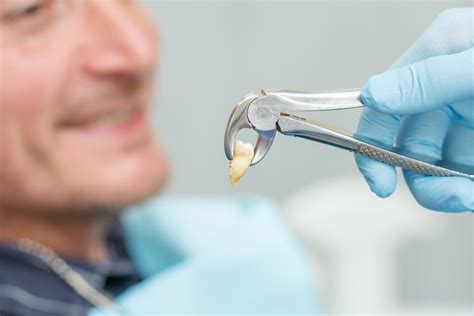 Tooth Care After A Tooth Extraction