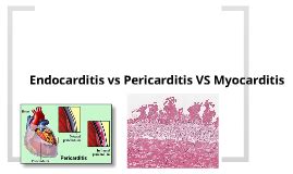 Examples of these medicines are aspirin. Endocarditis vs Pericarditis vs Myocarditis by Ethiran ...