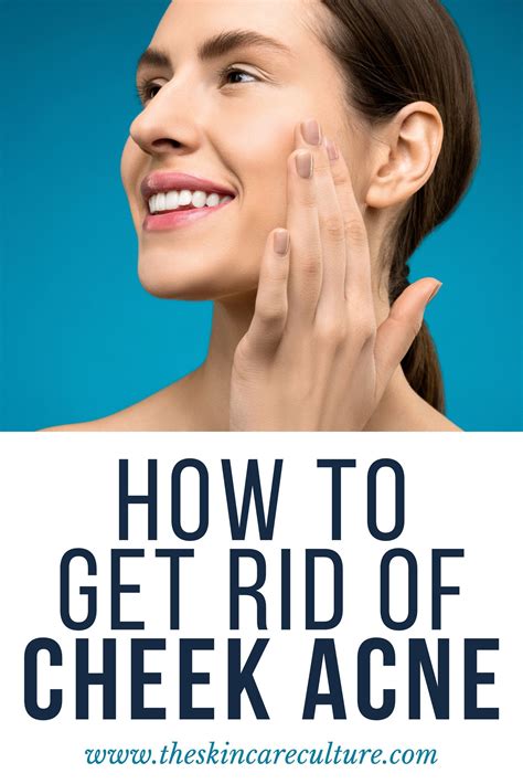 There Are Many Ways You Can Get Rid Of Cheek Acne However The Most