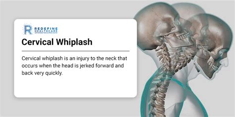 Cervical Whiplash Njs Top Orthopedic Spine And Pain Management Center