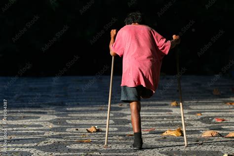 Disabled One Legged Handicapped Homeless Man Walking On Crutches At