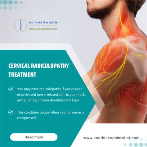 cervical radiculopathy a systematic review on treatment by spinal hot sex picture