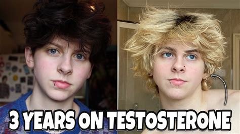 3 Years On Testosterone Ftm Transgender Noahfinnce Youtube