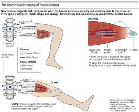 American academy of orthopaedic surgery: Cramp - exercise-induced. Causes, symptoms, treatment ...