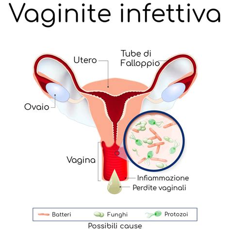 Probiome Vaginal Analisi Microbiota Vaginale Genes You
