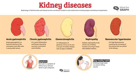 Urinary System Diseases Infographics To Understand Mind The Graph Blog