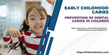 Early Childhood Caries Prevention Of Dental Caries In Children