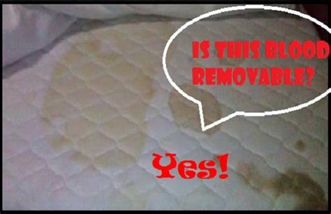 And yes, it happens to the best of us. How to Remove Blood Stain from Mattress | Mattress stains ...