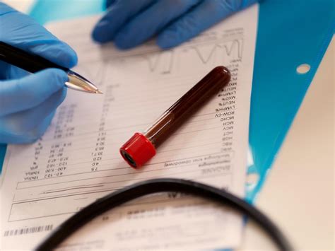 How Long Does It Take To Receive Blood Test Results A Guide