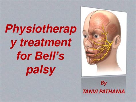 Bells Palsy Treatment Bells Palsy Symptoms Causes And Treatment