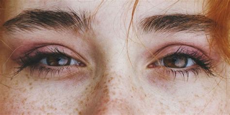 Facts About Freckles Weird Things About Freckles