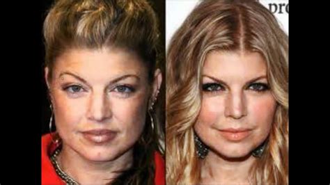 New Celebrity Plastic Surgery Before And After Pictures Youtube