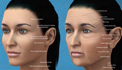 Facial Aging Anatomy Facial Rejuvenation Face Lift Surgery Facial