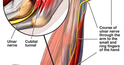 Ulnar Nerve Therapy And Treats On Pinterest