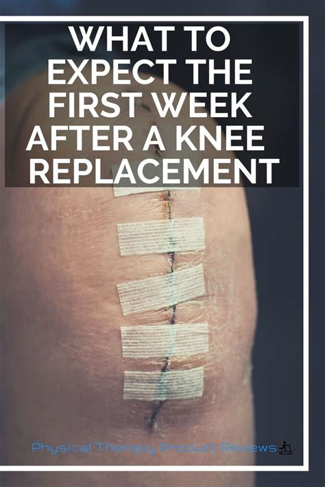 Complications After Knee Replacement Surgery Brandon Orthopedics