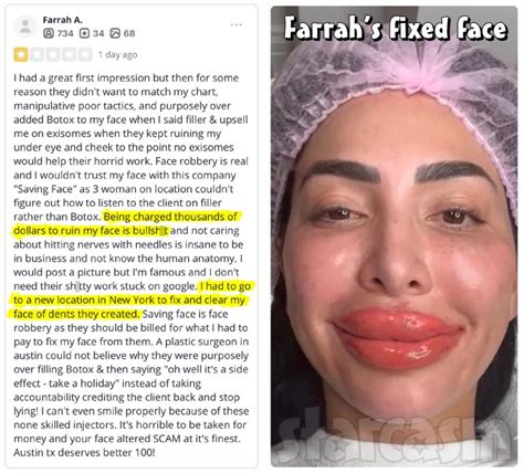Farrah Abraham Botched Face And Lip Injections Photos And Yelp Review