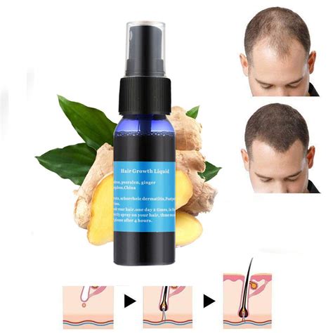 All women and most of the men would be delighted if their body hair were removed and never grew back. Okeny's yuda pilatory stop hair loss fast hair growth for ...
