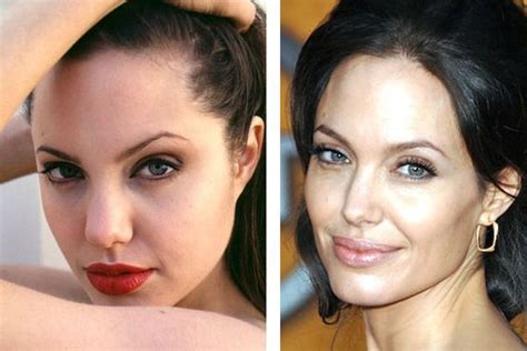 Angelina Jolie S Plastic Surgery Journey Vanity