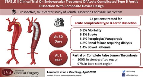 STABLE II Clinical Trial On Endovascular Treatment Of Acute