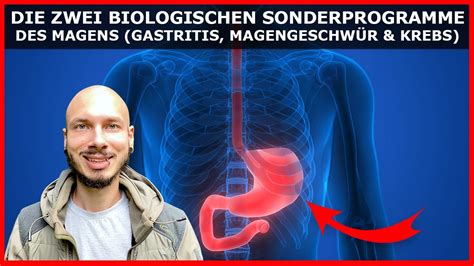 Gastritis Magengeschw R Und Magenkrebs Das Steckt Wirklich Hinter